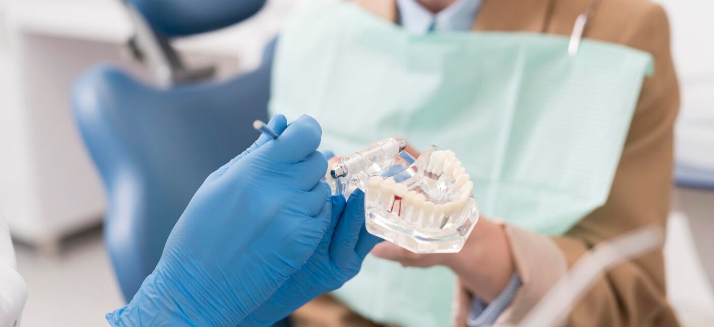 Dental Implants Warsaw