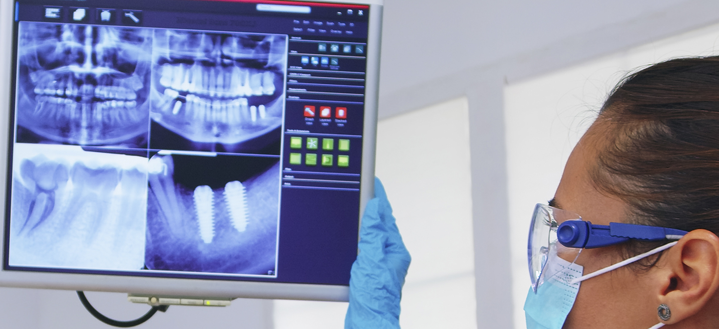 Dental X-ray Warsaw