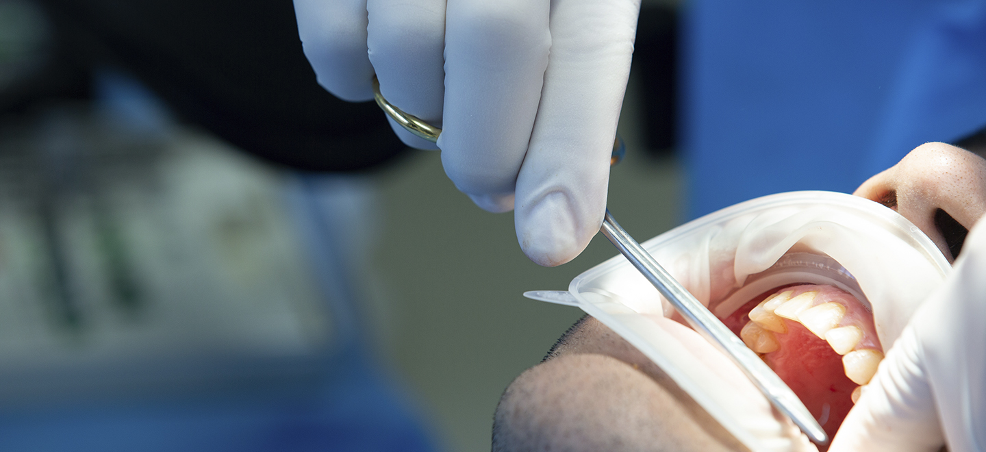 Oral Surgery Warsaw