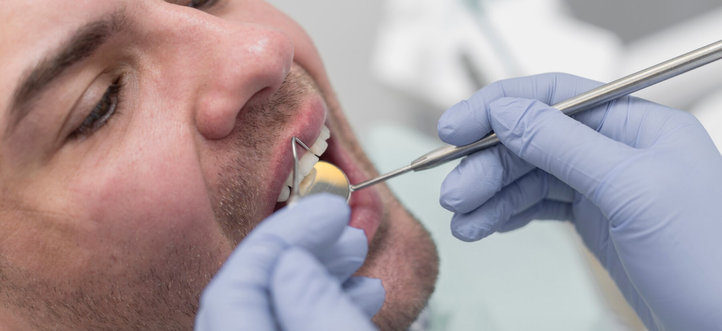 Tooth extraction Warsaw