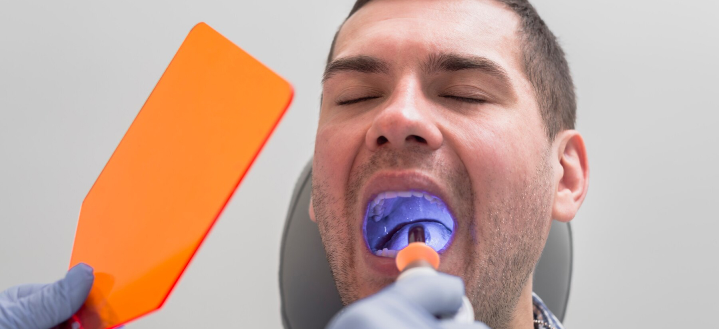 Wisdom Teeth Removal Warsaw