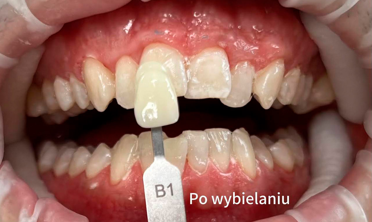 wybel-PO